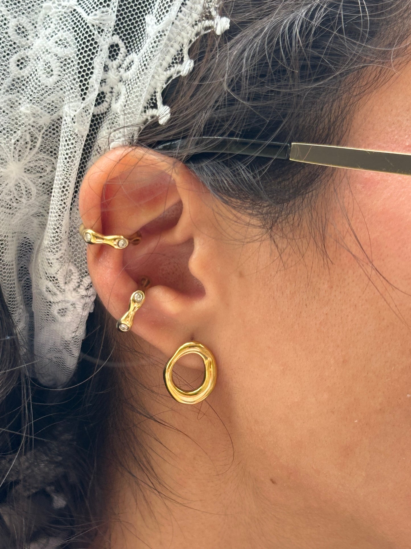 Arete Arauca
